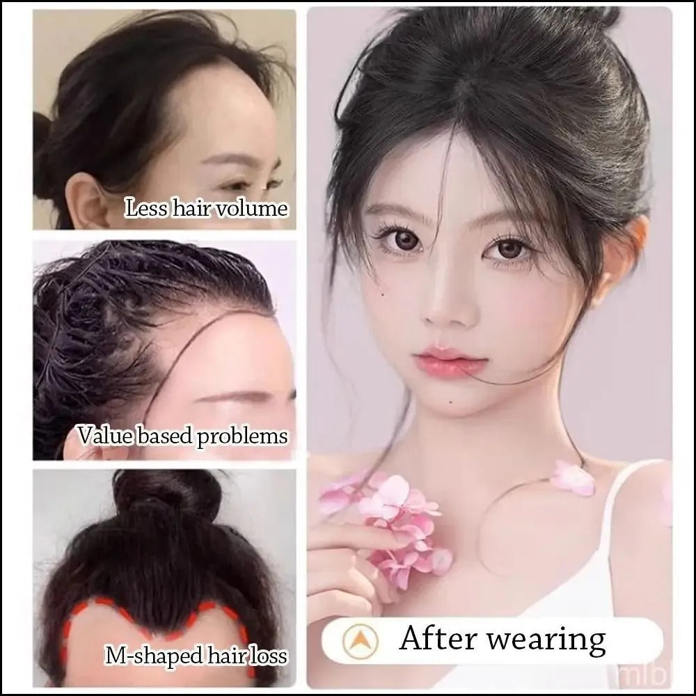 Best Front Line Hair